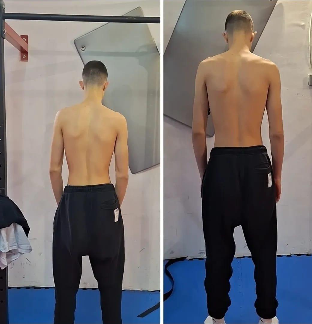 Držanje klijenta, pogled straga — prije i poslije